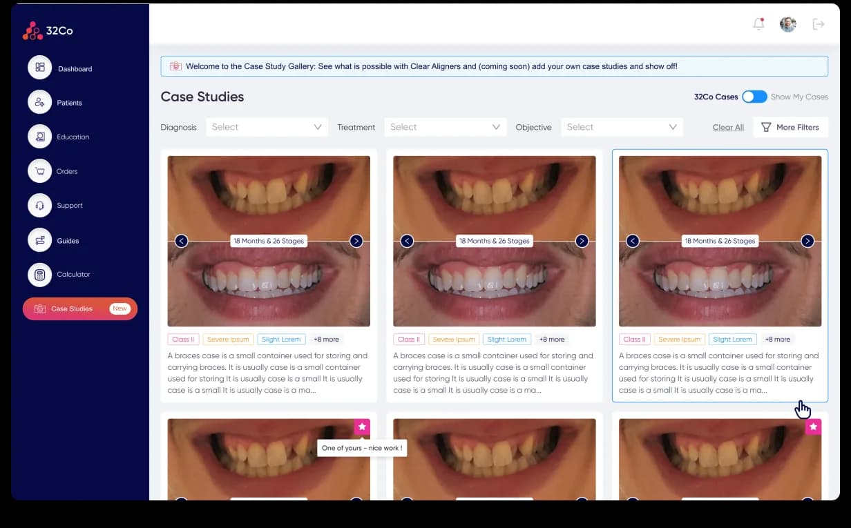 32co Case Studies. Welcome to the Case Study Gallery banner with a Clear Aligners and Coming Soon toggle, filter row (Diagnosis · Treatment · Objective) with Clear All and More Filters controls, a SDx Cases / Mine toggle, and a 3-column gallery of before/after smile photos each captioned with the diagnosis, treatment, and outcome from a real clinical case