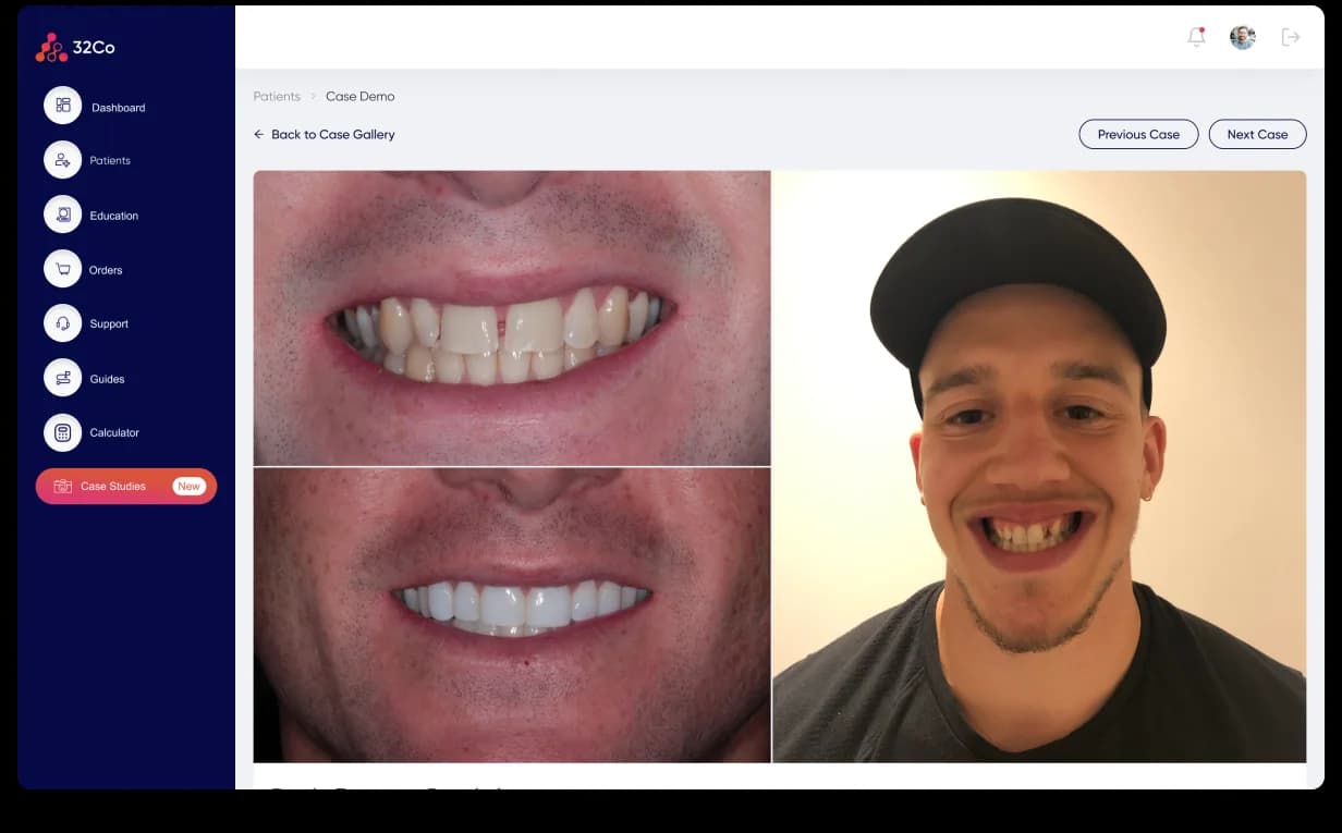 32co Case Studies · alternate detail view, case-study card expanded with full clinical context, treatment timeline, and supporting images; the same shell as the gallery, with the detail page reachable via URL so dentists can paste the case-study link straight into a patient conversation