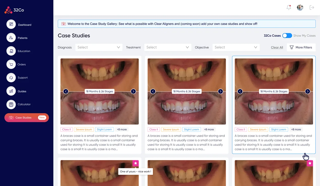32co Case Studies. Welcome to the Case Study Gallery banner with a Clear Aligners and Coming Soon toggle, filter row (Diagnosis · Treatment · Objective) with Clear All and More Filters controls, a SDx Cases / Mine toggle, and a 3-column gallery of before/after smile photos each captioned with the diagnosis, treatment, and outcome from a real clinical case